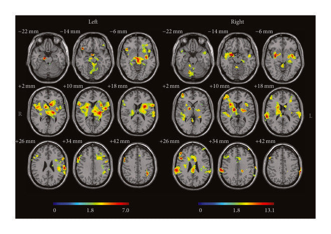 RESÚMEN DEL ARTÍCULO: "Investigating Acupuncture Using Brain Imaging Techniques: The Current State of Play"